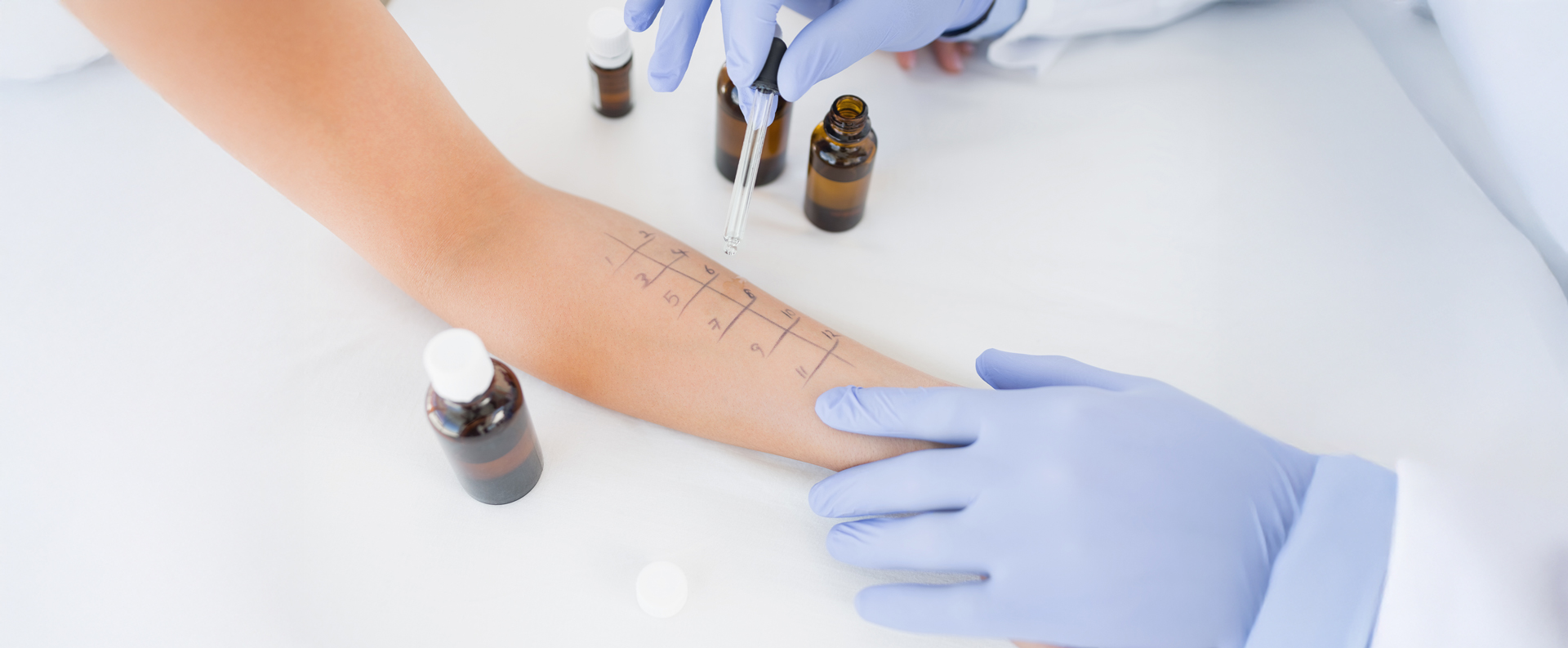 Allergien & Immuntherapie